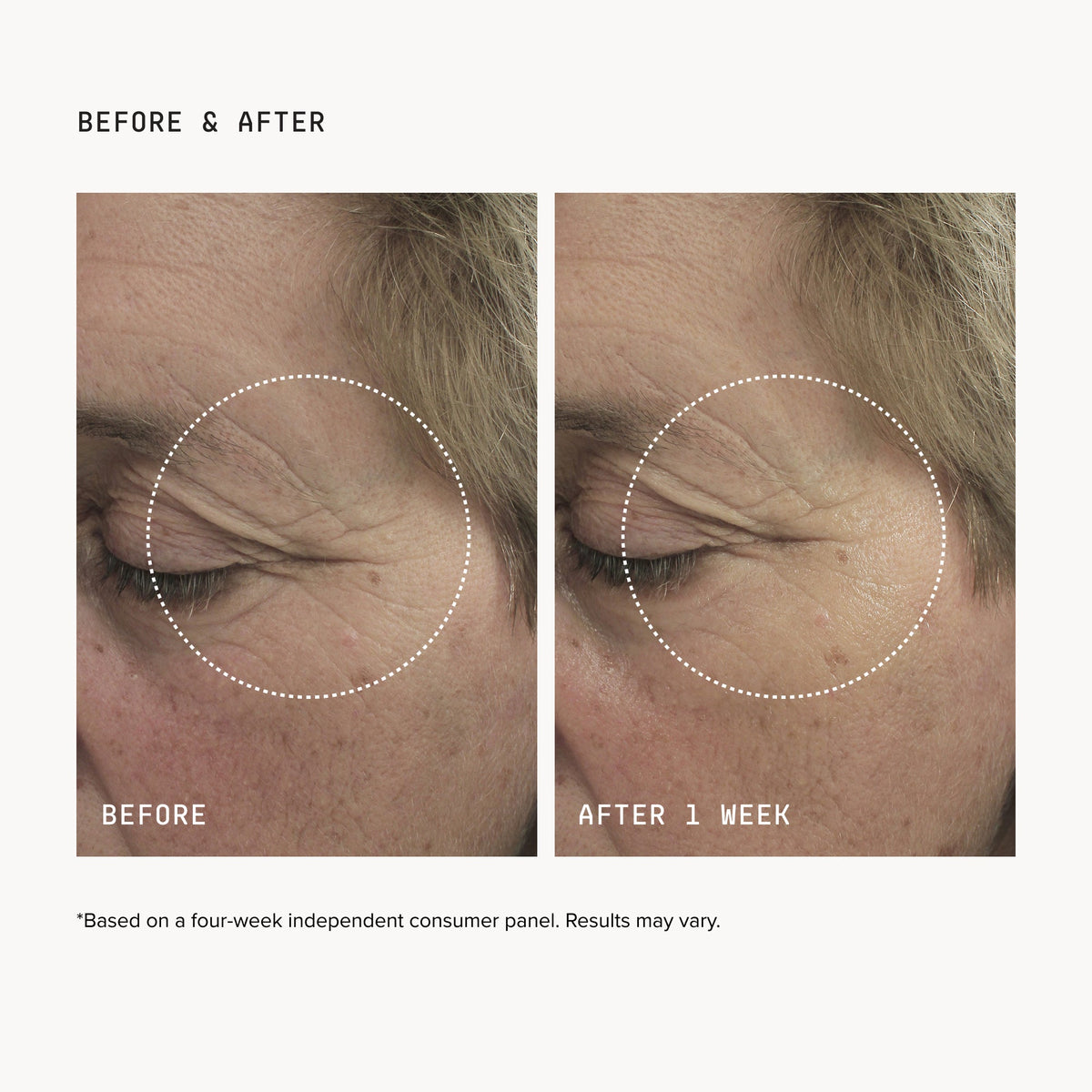 FacialRX® Brightening Eye Masks