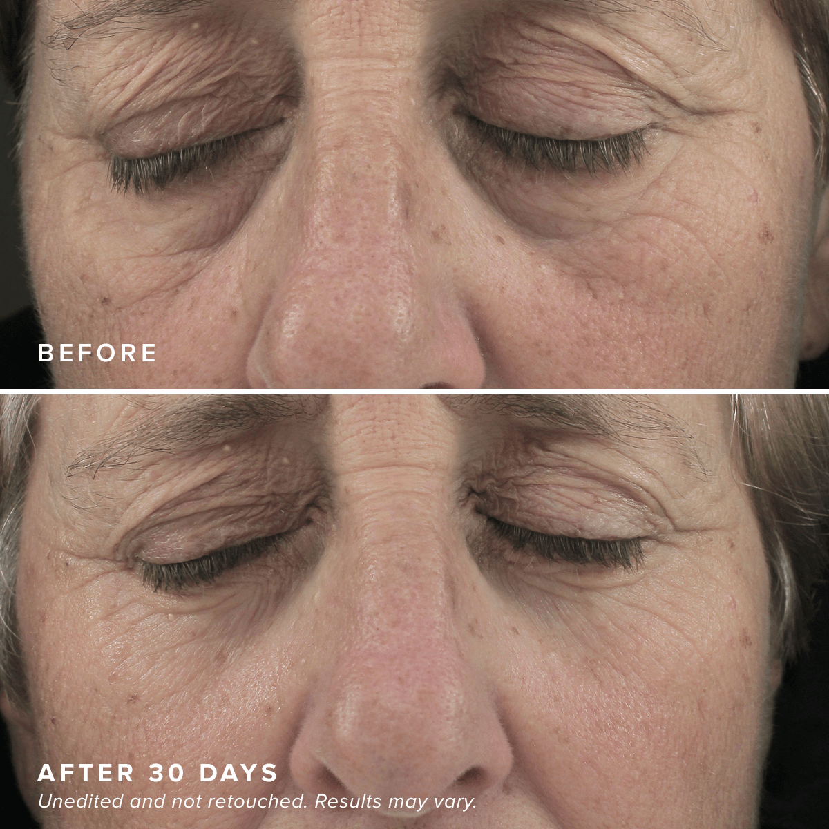 FacialRX® Brightening Eye Masks