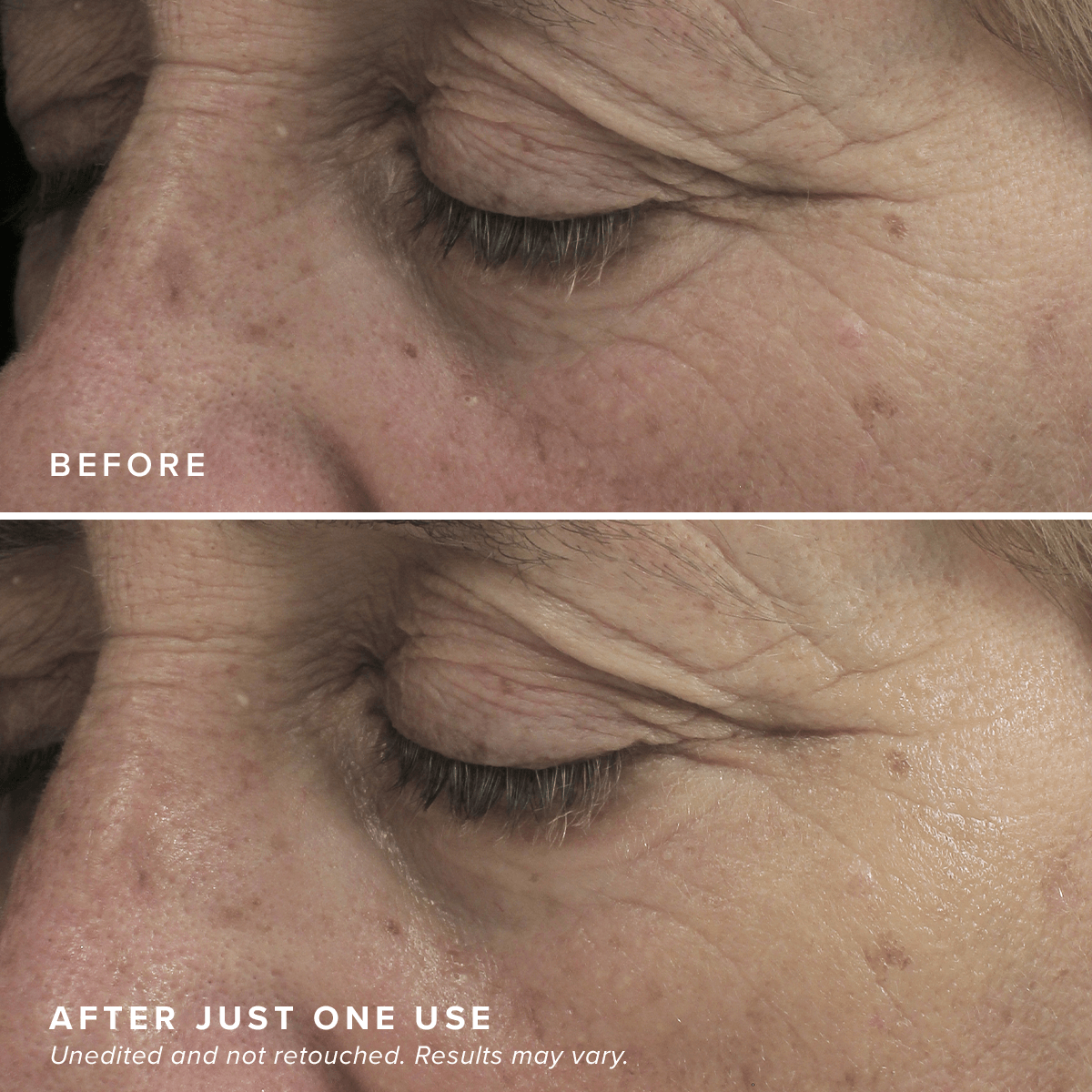 FacialRX® Brightening Eye Masks